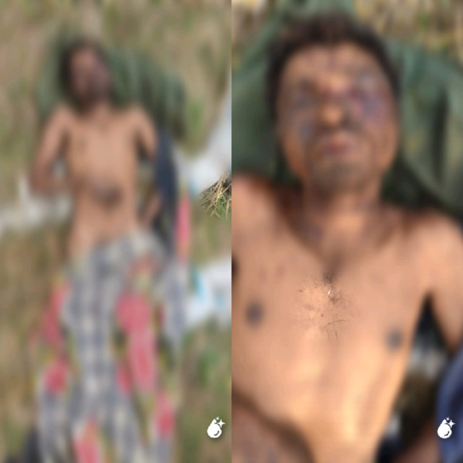 तिल्दा नेवरा।कोयला रेक प्वाइंट पर मिला अज्ञात व्यक्ति का शव, हत्या की आशंका गहराई